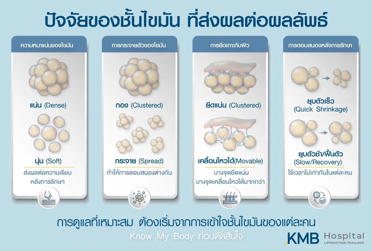 ภาพอินโฟกราฟิก KMB Hospital อธิบายปัจจัยของชั้นไขมันที่ส่งผลต่อผลลัพธ์ ได้แก่ ความหนาแน่น การกระจายตัว การยึดเกาะกับผิว และการตอบสนองหลังการรักษาที่แตกต่างกันในแต่ละบุคคล