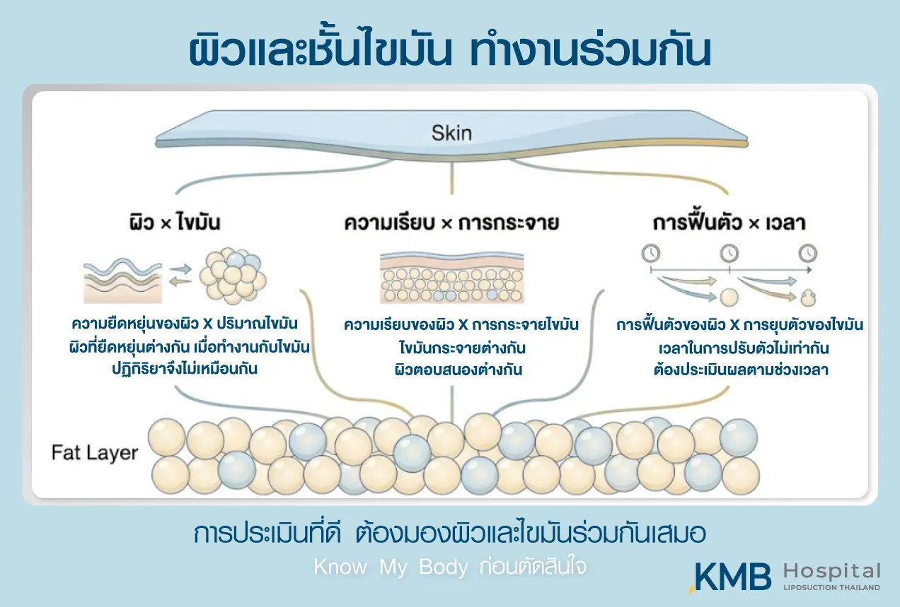 ภาพอินโฟกราฟิก KMB Hospital อธิบายการทำงานร่วมกันของผิวและชั้นไขมัน ทั้งความยืดหยุ่นของผิว ปริมาณและการกระจายไขมัน รวมถึงการฟื้นตัวตามเวลา ซึ่งส่งผลต่อความเรียบและผลลัพธ์หลังโปรแกรมดูดไขมัน