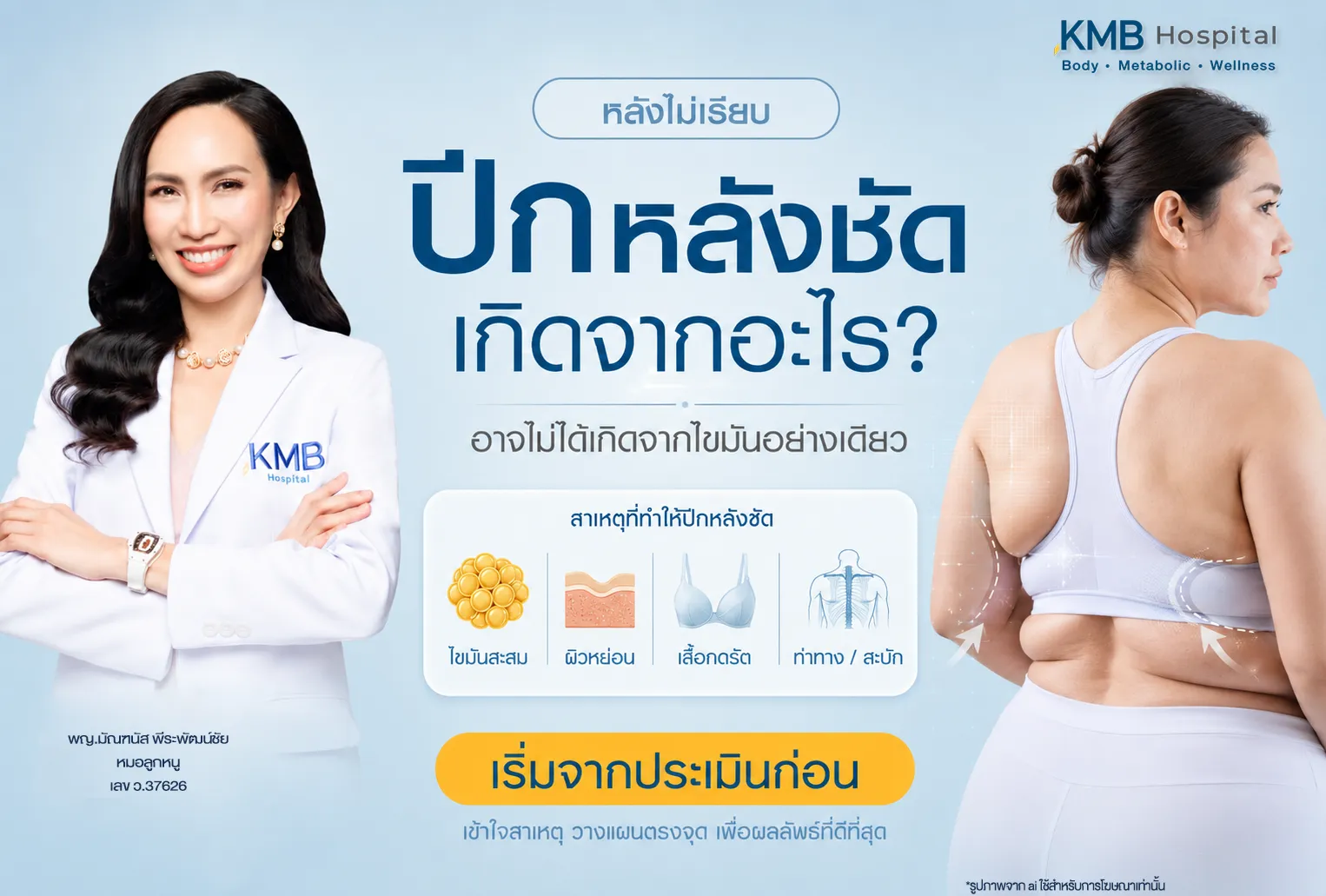 ภาพปกบทความ KMB Hospital อธิบายสาเหตุที่ทำให้ปีกหลังชัดหรือแผ่นหลังไม่เรียบ ได้แก่ ไขมันสะสม ผิวหย่อน เสื้อผ้ากดรัด และลักษณะท่าทางหรือสะบัก พร้อมเน้นการประเมินสาเหตุก่อนวางแผนดูแล